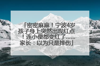 密密麻麻！宁波4岁孩子身上突然出现红点！连小便都变红了……家长：以为只是摔伤